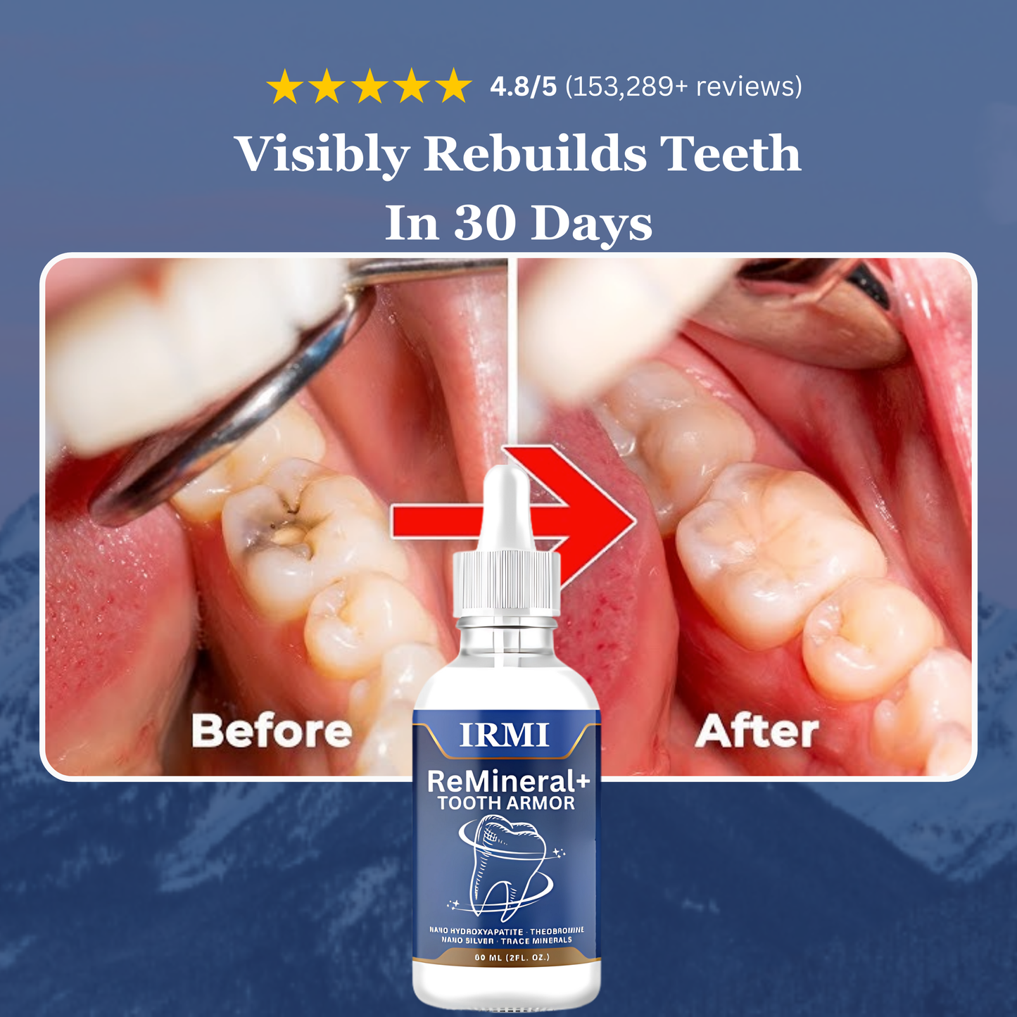 Advanced Tooth Healing ReMineral+
