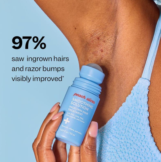 Ingrown Hair Treatment